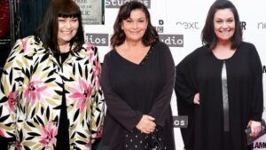 Dawn French Weight Loss 2022 Transformation