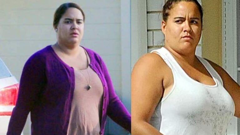 Sydney Simpson Weight Loss: Diet, Workout, Surgery Before & After ...