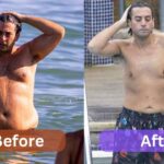 James Argent Weight Loss Journey, Surgery before & After