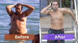 James Argent Weight Loss Journey, Surgery before & After