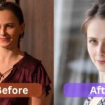 Pauline Chalamet Weight loss, Surgery Before & After