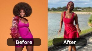 Amara la Negra Weight Loss, Surgery Before & After