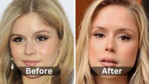 Erin Moriarty Plastic Surgery, Before & After | Myth or Reality
