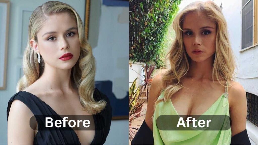 Erin Moriarty Plastic Surgery Before After 1024x576 