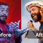 Post Malone weight loss, Surgery, Diet & Workout