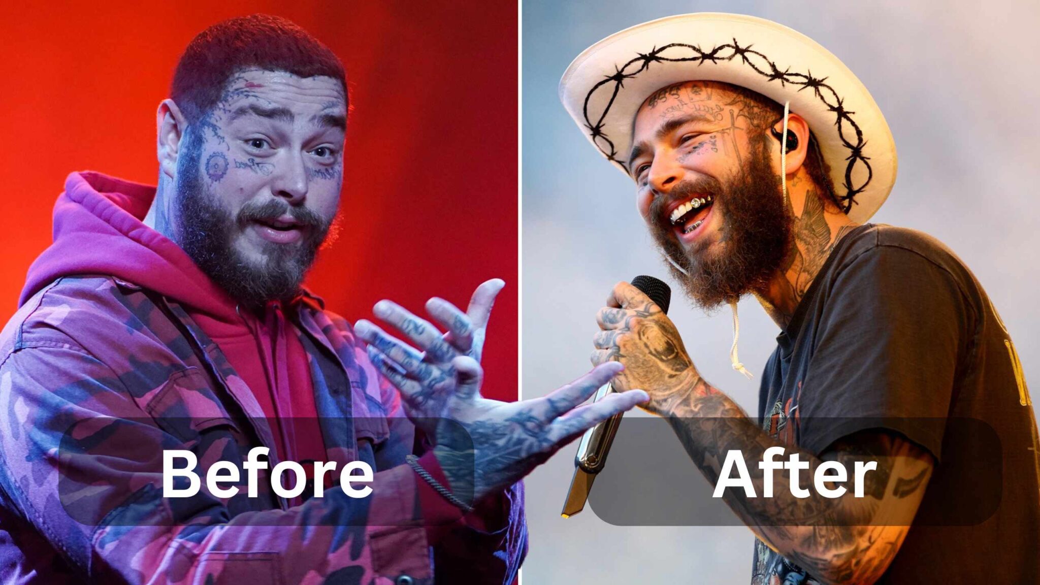 post-malone-weight-loss-surgery-diet-workout-weight-loss