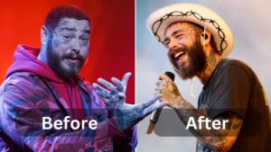 Post Malone weight loss, Surgery, Diet & Workout