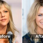 Kaitlin Olson Plastic Surgery, Before & After