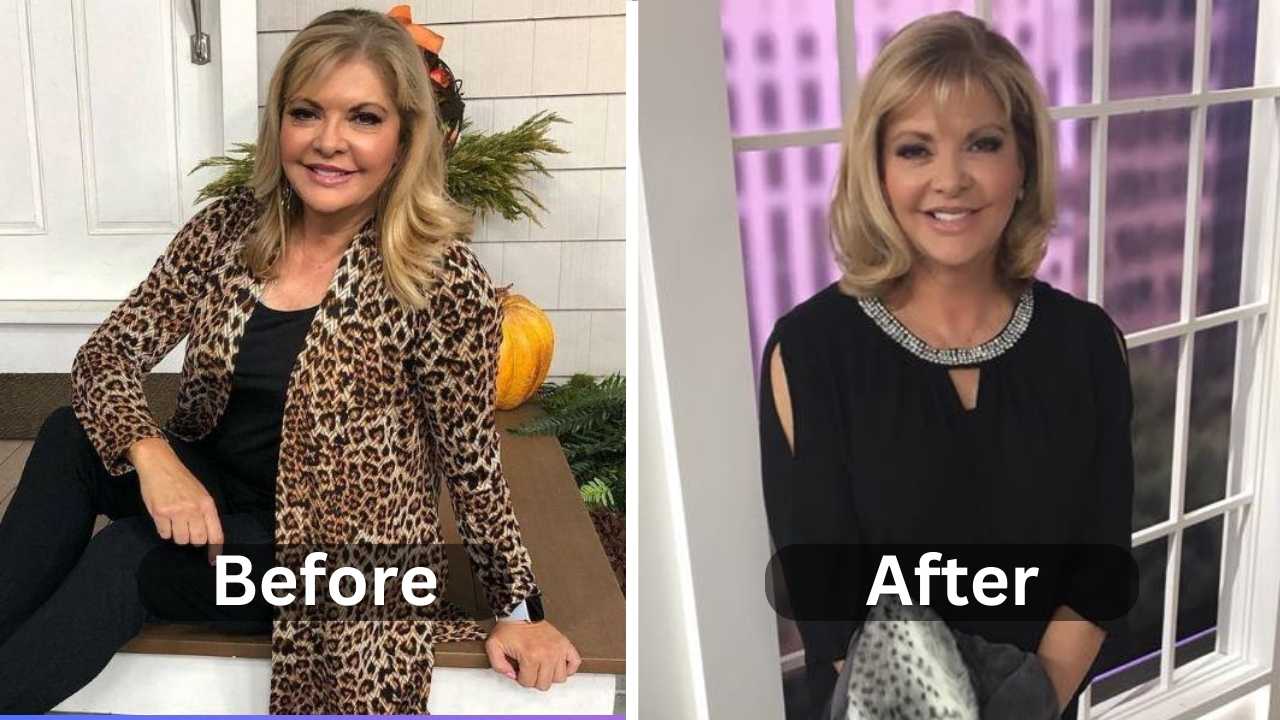 QVC pat James Dementri Weight Loss: An Inspiring Story