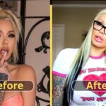 Bunnie Xo's Stunning Transformation: Before Plastic Surgery