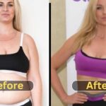 Josie Gibson Weight Loss: Surgery, Before After, Diet and Workout