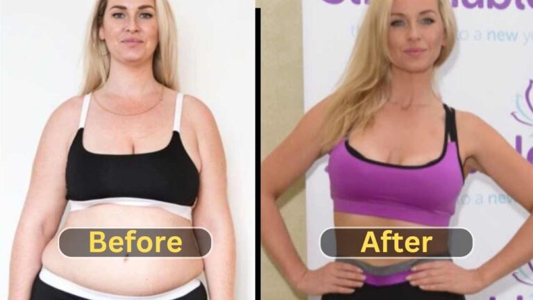 Josie Gibson Weight Loss Surgery Before After Diet And Workout Weight Loss 