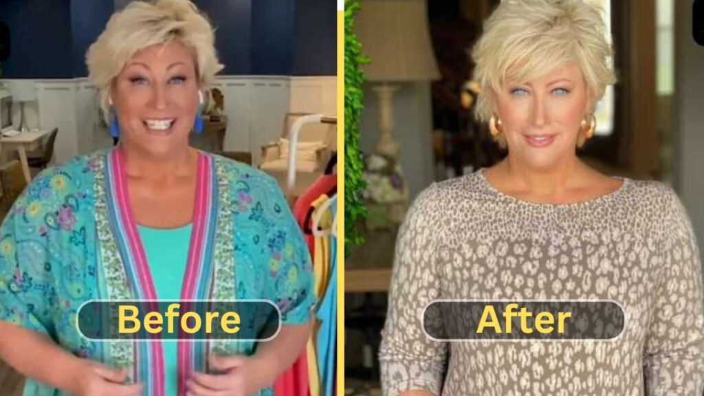 Kim-Gravels-Weight-Loss-Journey-and-Transformation-before-after.