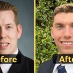Luke-Nichols-Weight-Loss-Workout-Diet-Plan-Surgery-Before-After-
