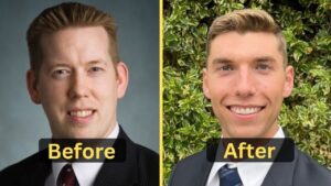 Luke-Nichols-Weight-Loss-Workout-Diet-Plan-Surgery-Before-After-