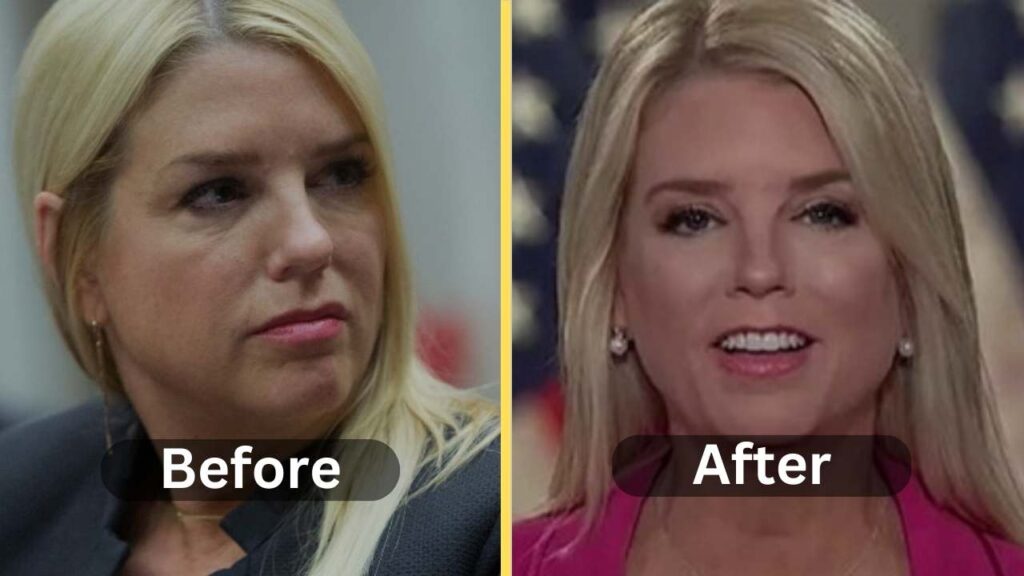 Pam Bondi Weight Loss Diet, Workout, Before and After Weight Loss