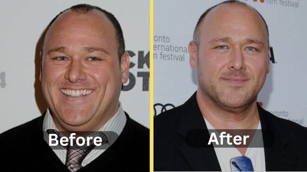 Will Sasso Weight Loss Diet Plan Workout Surgery Before After Weight Loss