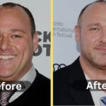 Will Sasso Weight Loss: Diet Plan, Workout, Surgery, Before & After