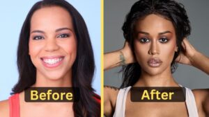 Anais Martinez's Weight Loss: Diet Plan, Workout, Surgery, Before and After