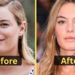 Camille Rowe's Weight Loss: Diet Plan, Workout, Surgery, Before & After