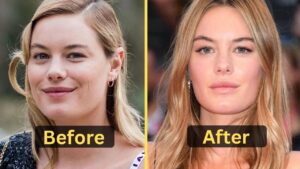 Camille Rowe's Weight Loss: Diet Plan, Workout, Surgery, Before & After