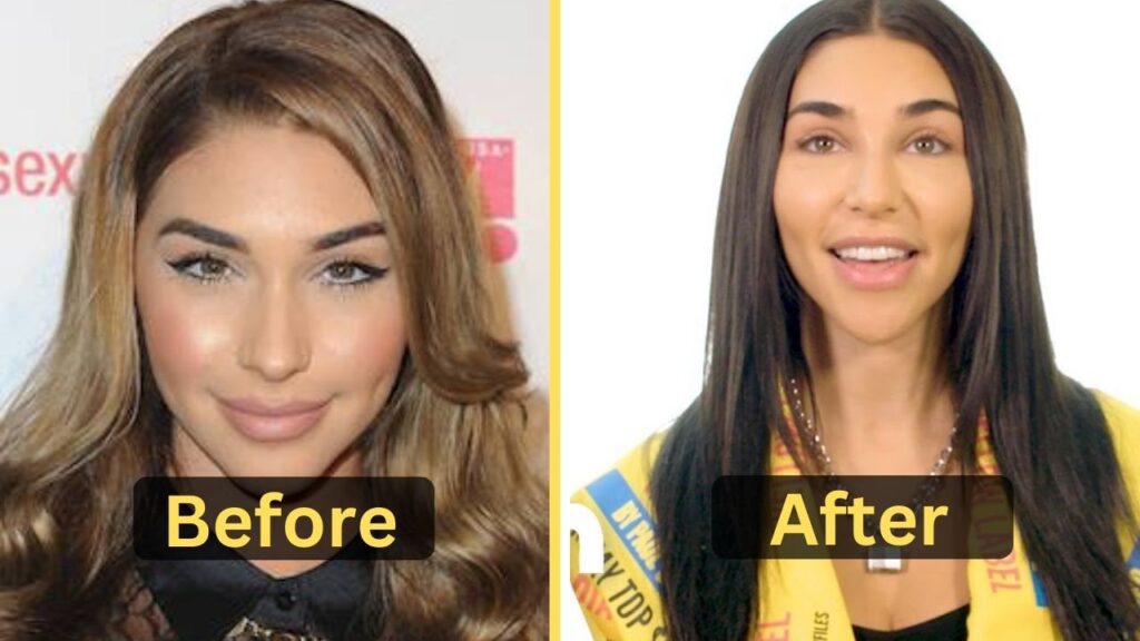 chantel-jeffries-weight-loss-diet-plan-workout-surgery-before-and