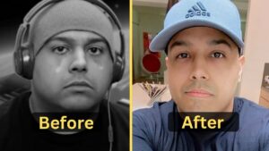 Dashie's Weight Loss: Diet Plan, Workout, Surgery, Before and After