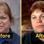 Dr. Brenda Grettenberger's Weight Loss: Diet Plan, Workout, Surgery, and Before& After