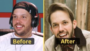 Heath Hussar's Weight Loss: Diet Plan, Workout, Surgery, Before and After