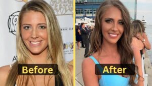 Jenna Compono Wight Loss: Diet Plan, Workout, Surgery, Before & After