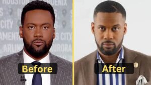 Lawrence Jones Weight Loss Success: Diet Plan, Exercise, Surgery, and Before & After