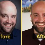 Lee Syatt Weight Loss: Diet Plan, Workout, Surgery, Before and After