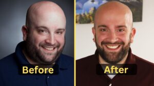 Lee Syatt Weight Loss: Diet Plan, Workout, Surgery, Before and After