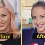 Lily Marston's weight loss: Diet Plan, Workout, Surgery, Before & After