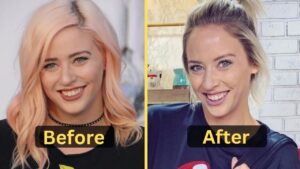 Lily Marston's weight loss: Diet Plan, Workout, Surgery, Before & After