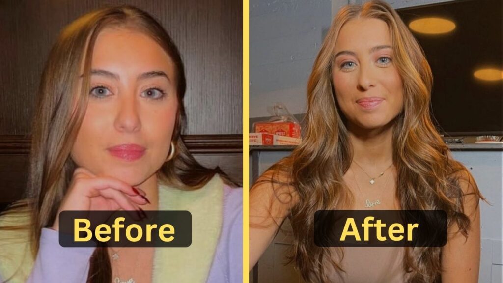 Margo Oshry Weight Loss: Diet Plan, Workout, Surgery, Before and After