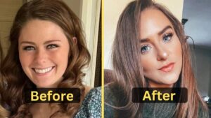 Miranda Simms Weight Loss: Diet Plan, Workout, Surgery, Before & After