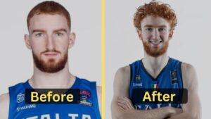 Nico Mannion's Weight Loss: Diet Plan, Workout, Surgery, Before & After