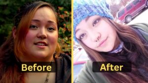Raquell Rose's Weight Loss: Diet Plan, Workout, Surgery, Before and After
