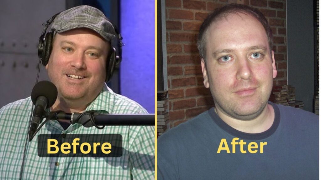 Benjy Bronk's Weight Loss: Diet Plan, Workout, Surgery, Before & After