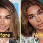 Chantel Jeffries Weight Loss: Diet Plan, Workout, Surgery, Before & After