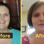 Dottie's Weight Loss: Diet Plan, Workout, Surgery, Before & After