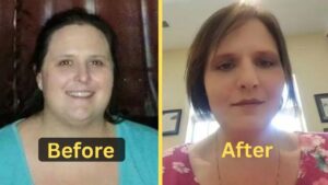 Dottie's Weight Loss: Diet Plan, Workout, Surgery, Before & After