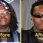 Gunna's Weight Loss: Diet Plan, Workout, Surgery, Before & After