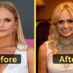 Miranda Lambert Weight Loss: Diet Plan, Workout, Surgery, Before & After