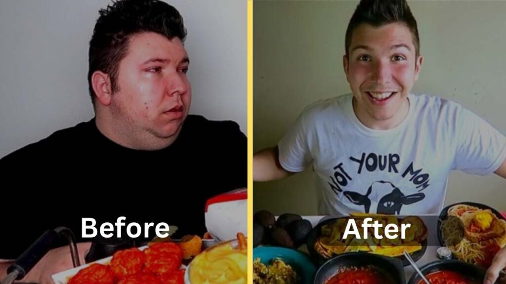 Nikocado Avocado Weight Loss Diet Surgery Before After Weight Loss