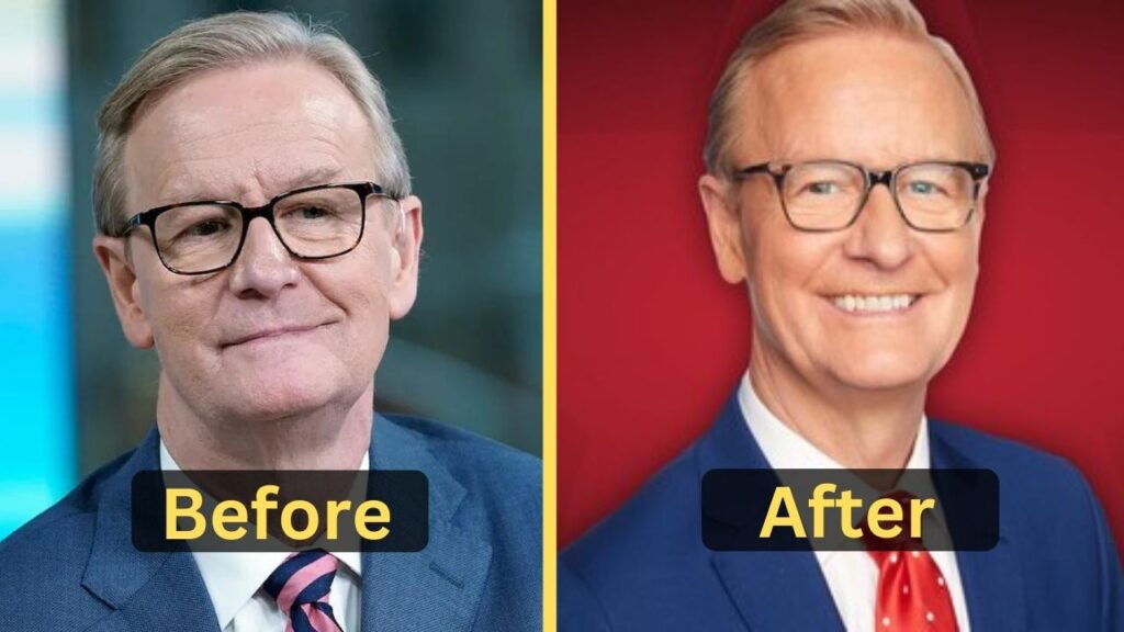 Steve Doocy's Weight Loss: Diet Plan, Workout, Surgery, Before & After