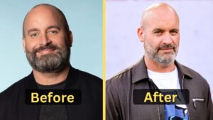 Tom Segura Weight Loss: Diet Plan, Workout, Surgery, Before & After