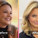 Emmy Medders Weight Loss Diet, Workout, Surgery and Before After