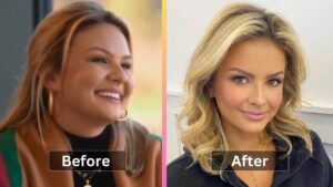 Emmy Medders Weight Loss Diet, Workout, Surgery and Before After